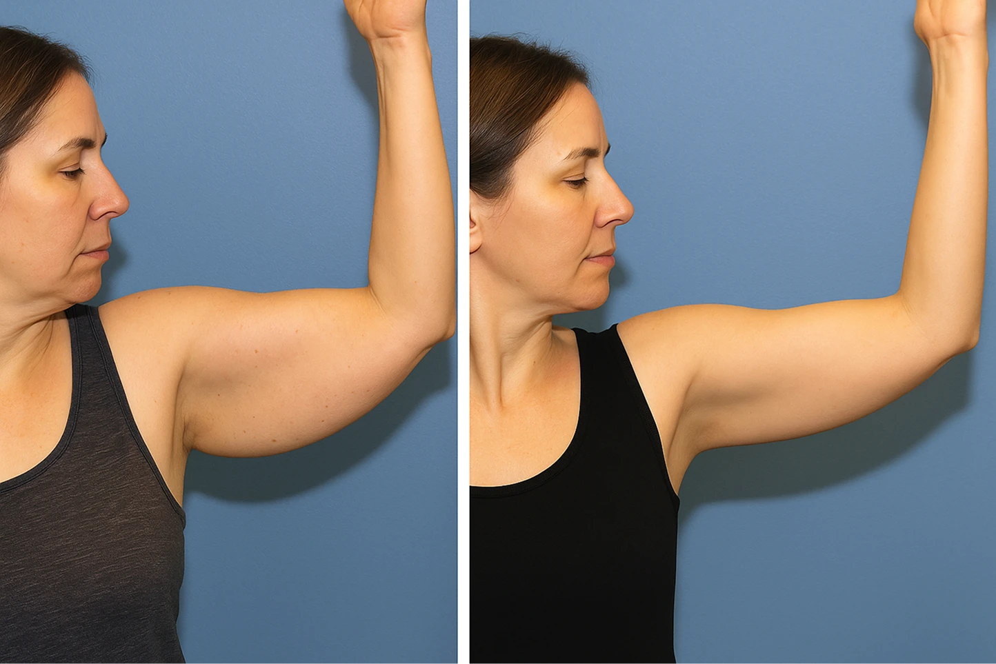 Before and After Results